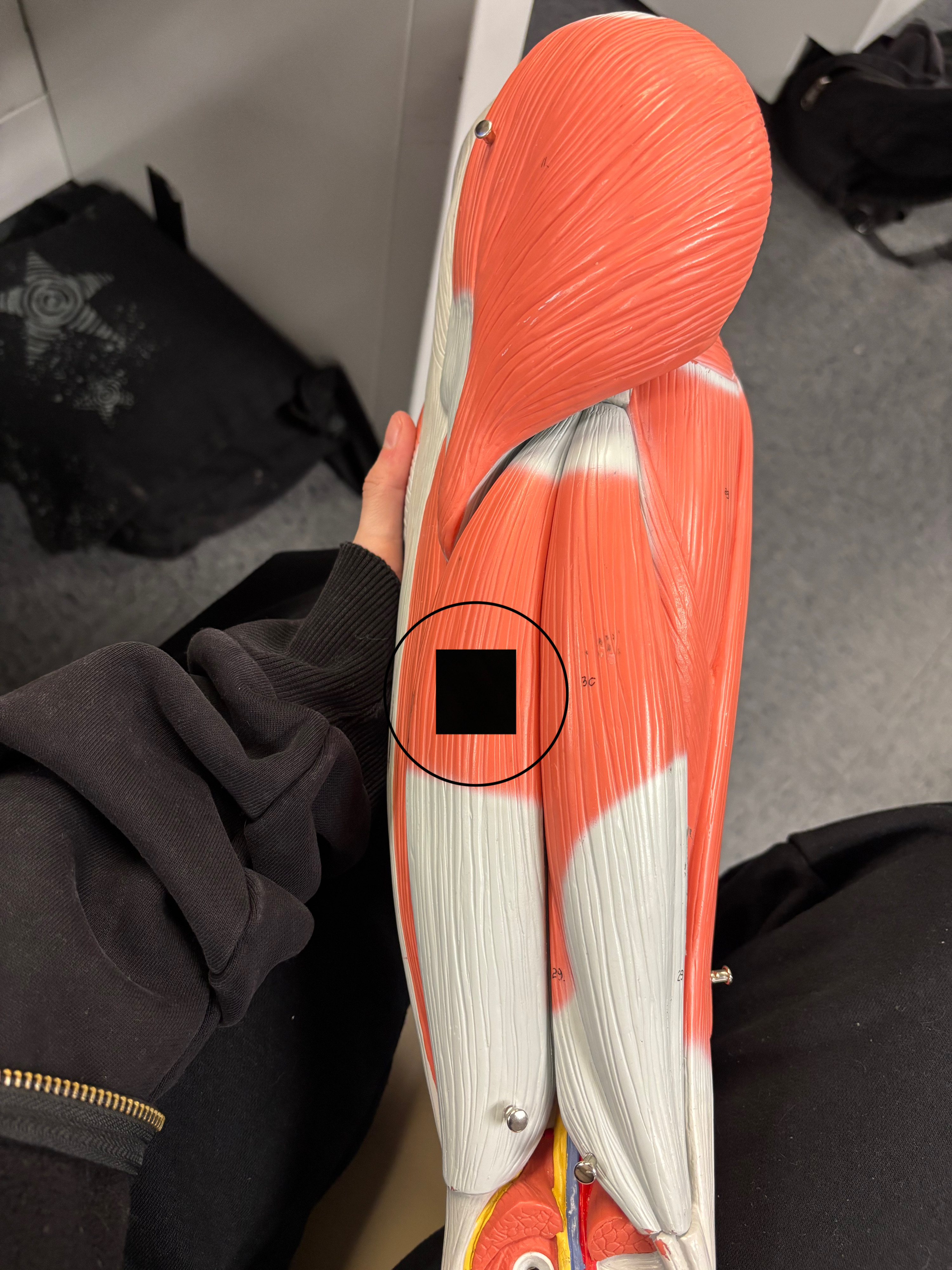 <p>What muscle is this and what is its action?</p>