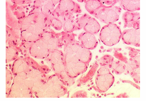<p>what gland is this and why</p>
