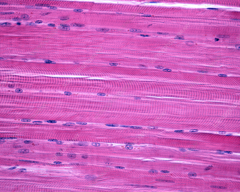 <p>-Function: Produces voluntary movement, maintains posture, and stabilizes joints</p><p>-Found: Attached to bones throughout the body</p><p>-Description: Long, cylindrical, striated cells with multiple nuclei</p>