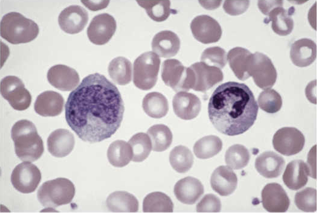 <p>Circle on right</p>