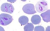 <p>Overgedragen door teken</p><p>symptomen: </p><ul><li><p>koorts</p></li><li><p>bloedarmoede</p></li><li><p>roodbruine urine</p></li></ul><p></p>