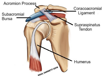 <p>Located between+separates acromion from supraspinatus</p><p>Does not communicate with articular cavity</p><p>Fused with subdeltoid bursa</p>