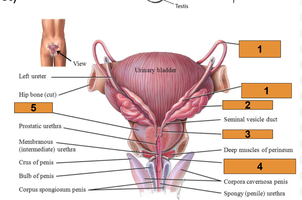 <p>Label this photo</p>