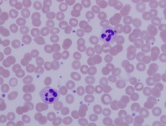 <p>blood</p>