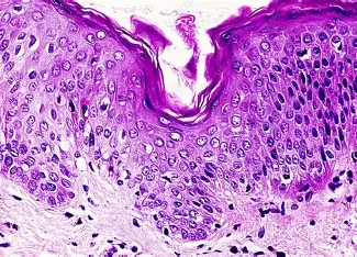 <p>Which kind of tissue is shown?</p>