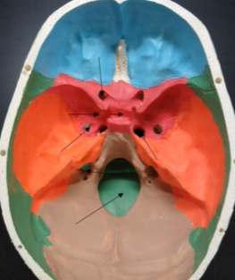 <p>What is this? (lower hole in the orange region)</p>