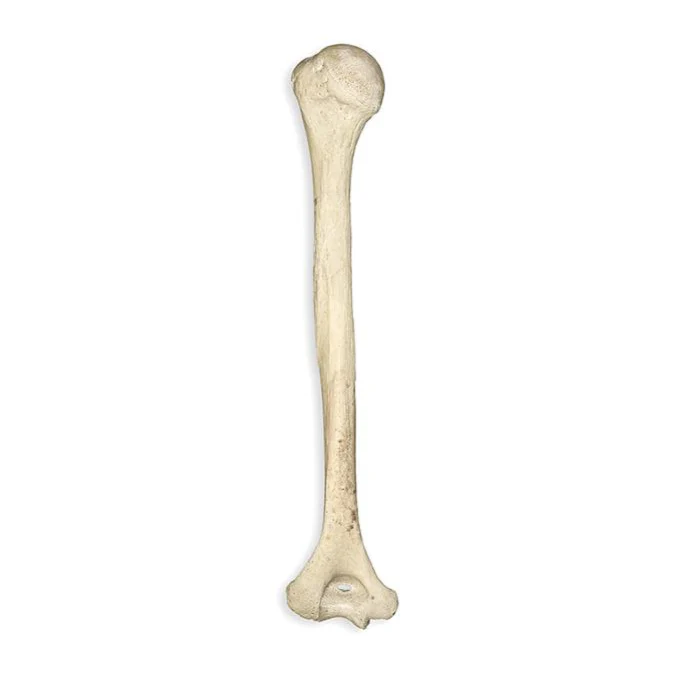 <p>What detached bone is this?</p>