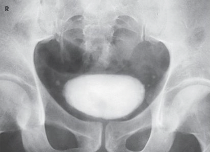 <p> What is this projection and what is the CR angle?</p>