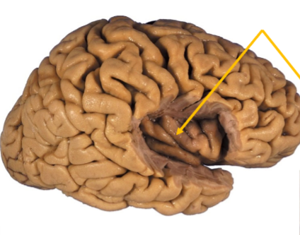 <p>Hidden deep within the lateral sulcus of the brain</p>