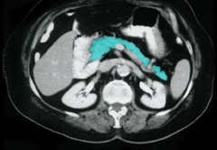 <p>Identify the imaging, plane, and highlighted structure</p>