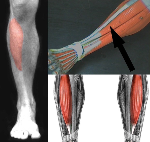 <p>What muscle is this?</p>