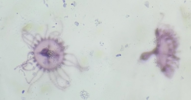 <p>What phylum and class is this? What life stage is this?</p>