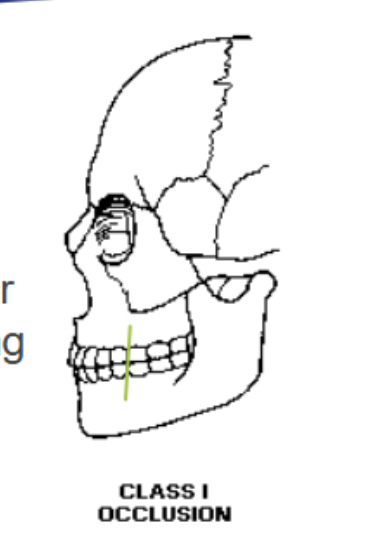 <p>Class I (normal) occlusion </p>