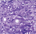 <p>What tissue (cartilage)</p>