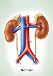 <p>ex) patient’s right kidney is on the left to my pov</p>