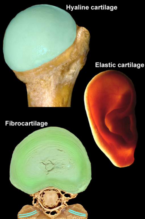 <p>Flexible cartilage which forms discrete structures in the external ear, auditory tube, &amp; parts of larynx</p><ul><li><p>Contains bundles of elastic fibres → permits strength &amp; elasticity while maintaining shape</p></li><li><p>Examples:</p><ul><li><p>Ear</p></li><li><p>Epiglottis (separates the windpipe &amp; oesophagus) </p></li></ul></li></ul><p></p>