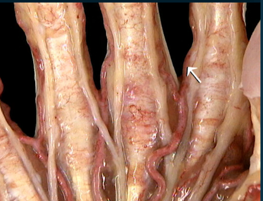 <p>Oppervlakkig, vingern anterior</p>