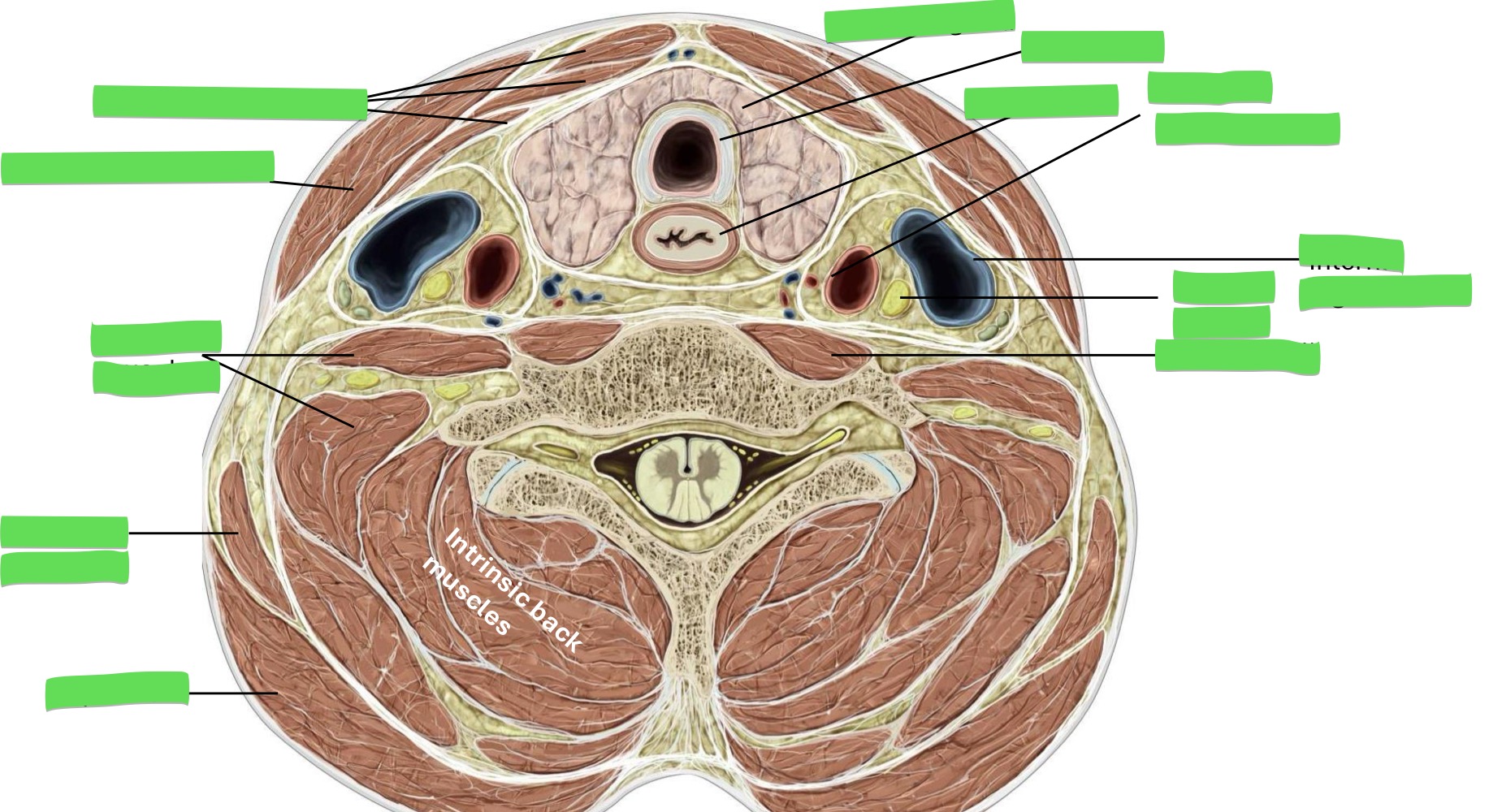 <p>Fill in the blank </p>