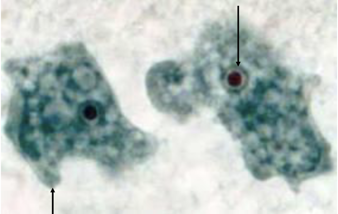 term image