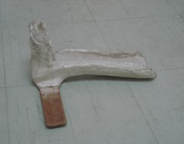 <p>hip<span> </span>surgery<span> </span>(partial<span> </span>and<span> </span>total<span> hip SURGERY</span></p>