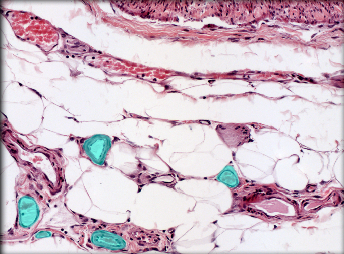<ul><li><p><strong>Location: </strong>Connect muscular (distributing) arteries with capillaries</p></li><li><p><strong>Function: </strong>Supplies blood to capillaries</p></li><li><p><strong>Description:</strong></p><ul><li><p>Arteries with overall diameter 40-200 µm</p></li><li><p>Tunica media has one to three layers of smooth muscle</p></li></ul></li><li><p><strong>Comment:</strong></p><ul><li><p>Companion vessels to venules</p></li><li><p>Primary point for control of blood flow to organs</p></li></ul></li></ul><p></p>