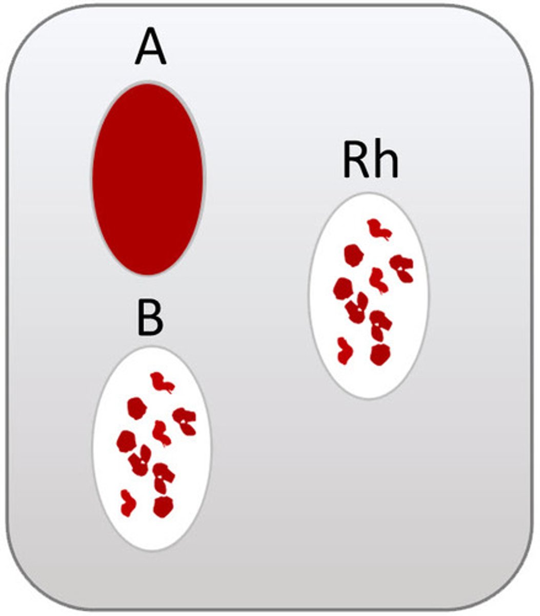 <p>B+</p>