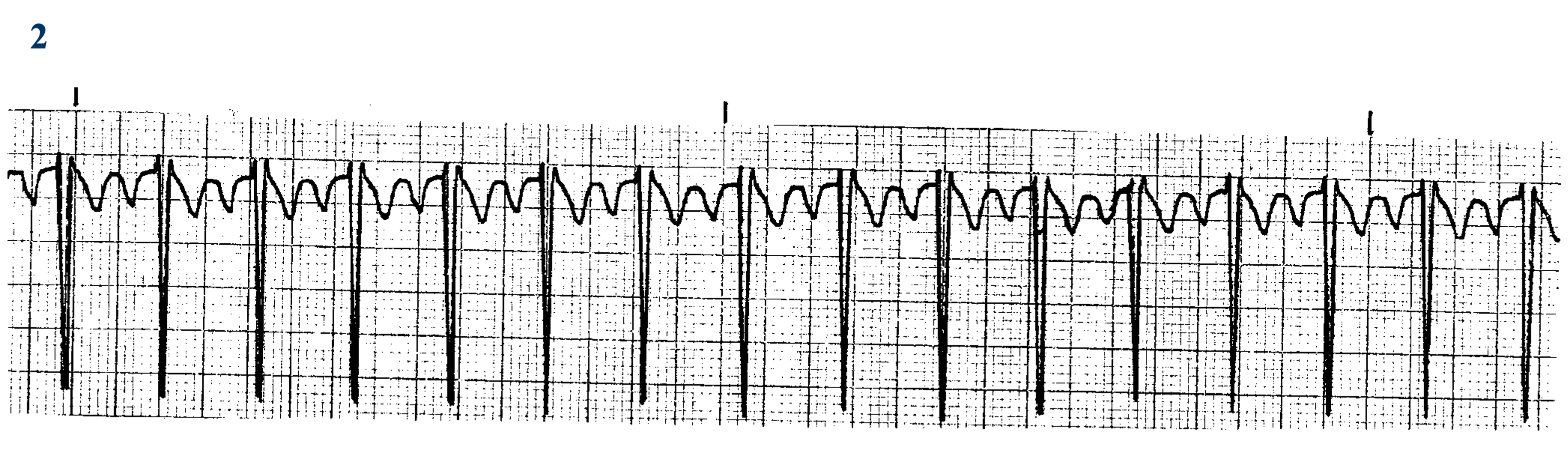 <p>What ECG is this? </p>