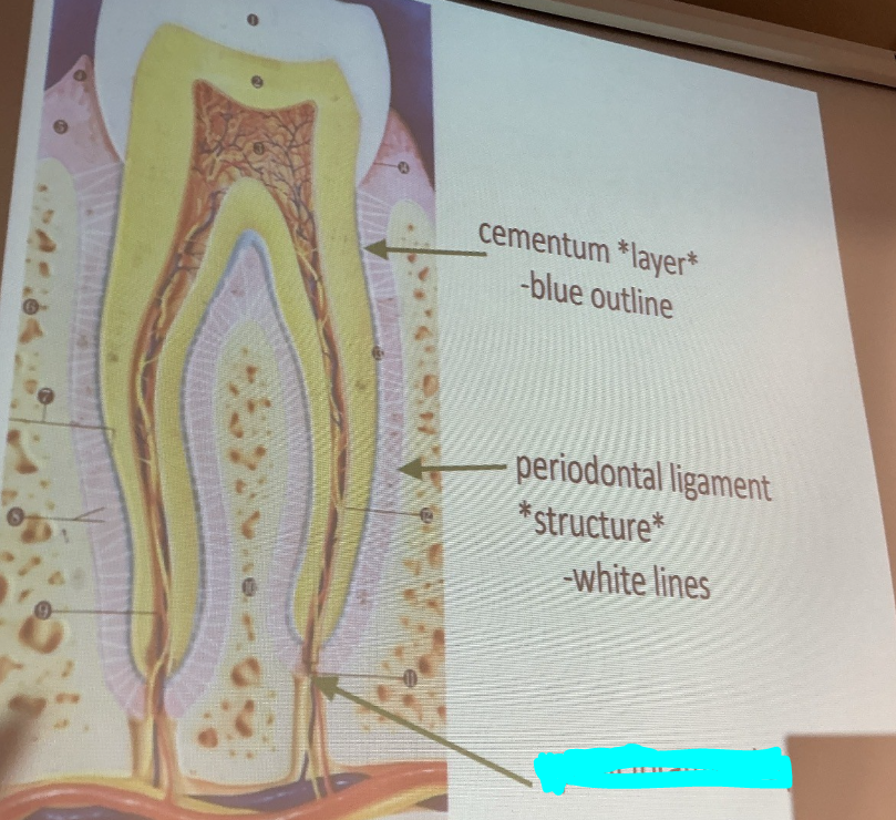 <p>Name this opening</p>