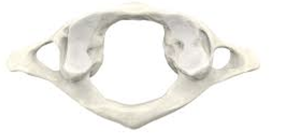 <p><span style="line-height: 18.4px;"><strong>What type of vertebrae is in the following photo?</strong></span></p><p><span style="line-height: 115%;"><strong>a.</strong></span><span><strong>&nbsp;</strong></span><span style="line-height: 18.4px;">Cervical</span></p><p class="MsoNormal"><span style="line-height: 115%;"><strong>b.</strong></span><span><strong>&nbsp;</strong></span><span style="line-height: 18.4px;">Thoracic</span></p><p class="MsoNormal"><span style="line-height: 18.4px;"><strong>c. </strong>Lumbar</span></p>