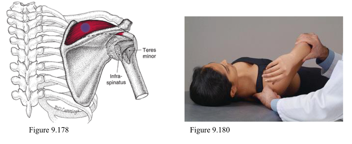 <p>F Abd ER</p><p>Location is in belly of supraspinatus muscle</p><ol><li><p>Pt supine</p></li><li><p>Physician sits by pt at level of shoulder girdle</p></li><li><p>Palpate tender point and use other hand to move arm</p></li><li><p>Flex arm 45 degrees, abduct 45 degrees, externally rotate (like a parade wave or Statue of Liberty)</p></li></ol><p></p>