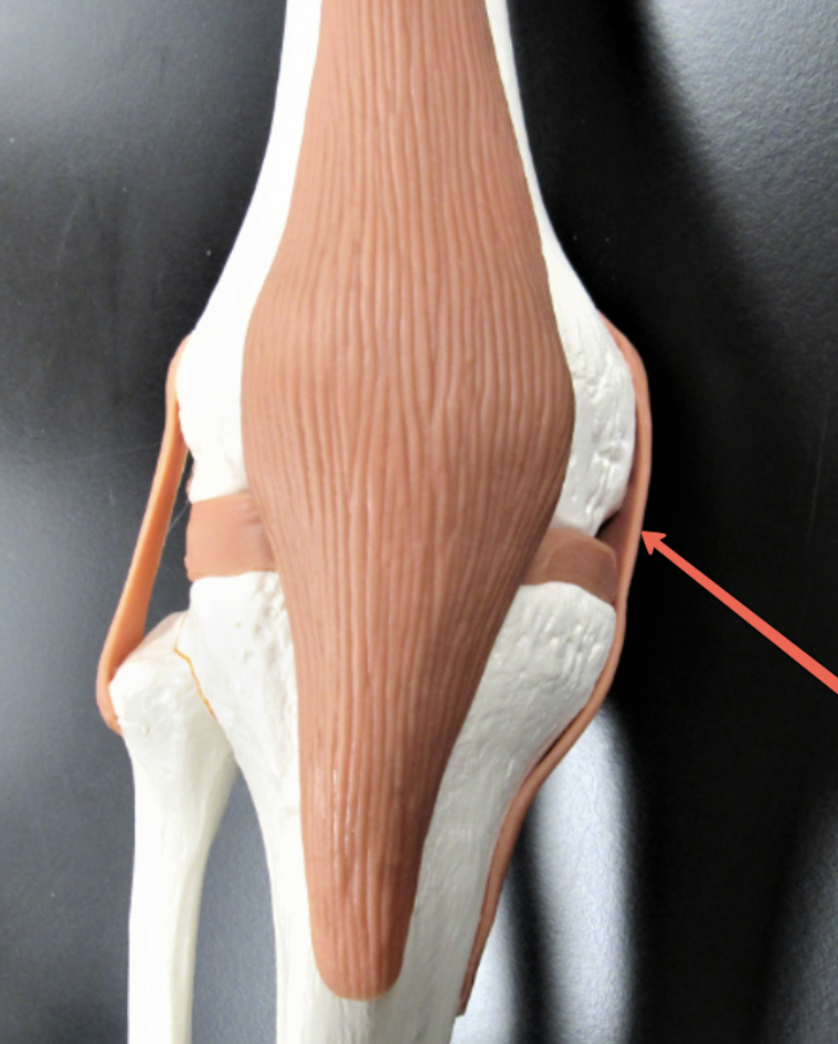 <p><span><strong>Identify the structure indicated by the pointer.</strong></span></p>
