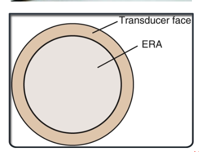 <p>the area of the transducer that emits ultrasound energy effectively. It is typically less than the total size of the transducer face and is crucial for determining the intensity of ultrasound delivered to the tissue. </p>