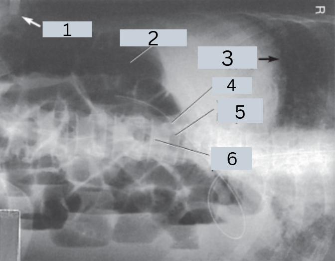 <p>label radiograph</p>