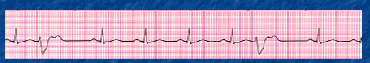 <p>What is this?</p>