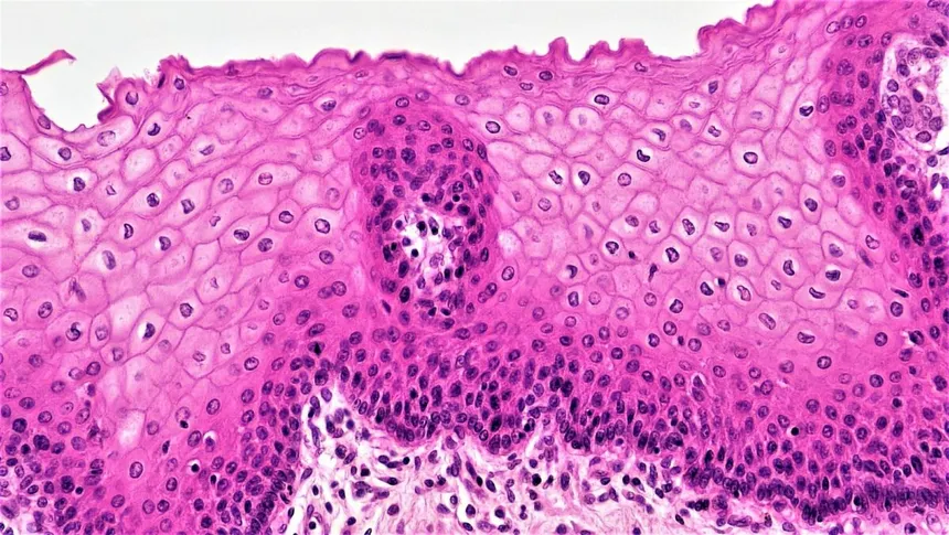 <p>Stratified epithelium</p>