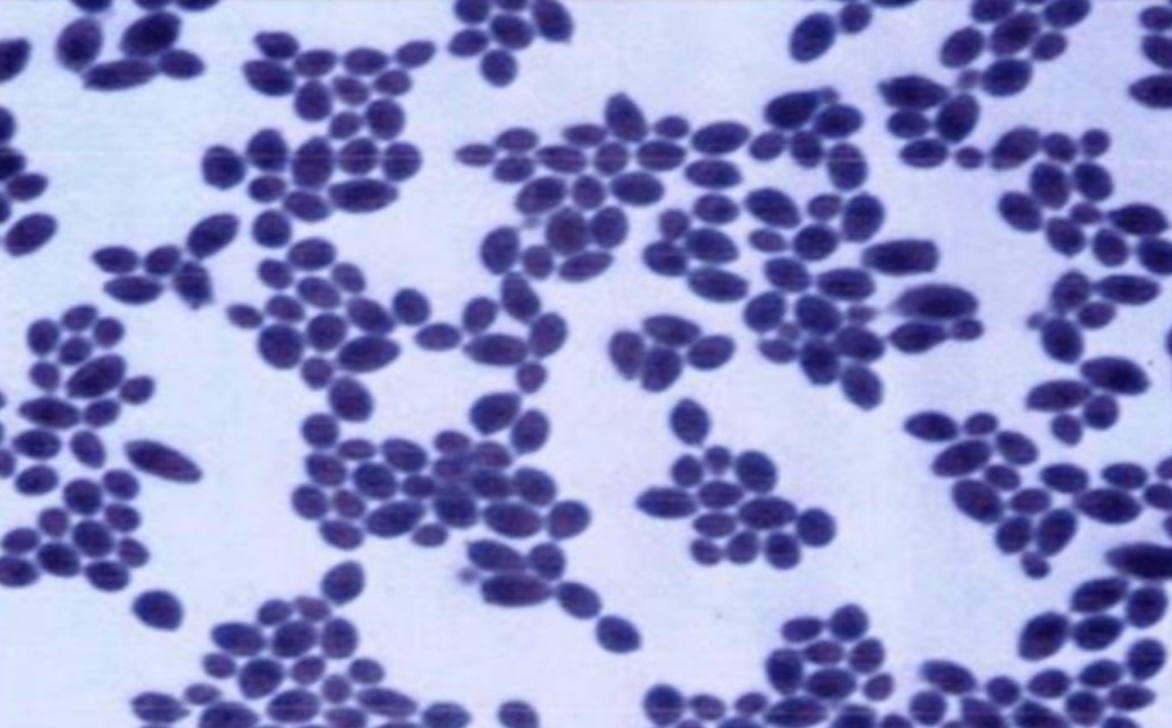 <p>Specimen (microscopically slide):</p><p>• Name of organism:</p><p>• Stain:</p><p>• Sample from: culture or pus or in tissue</p><p>• Morphology</p>