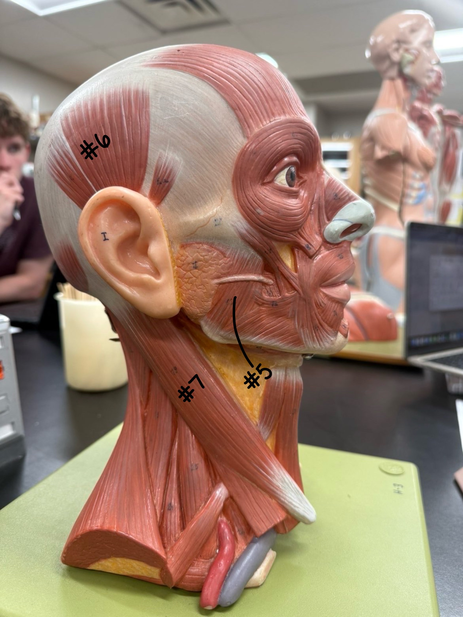 <p>What muscle is labeled #5? </p>