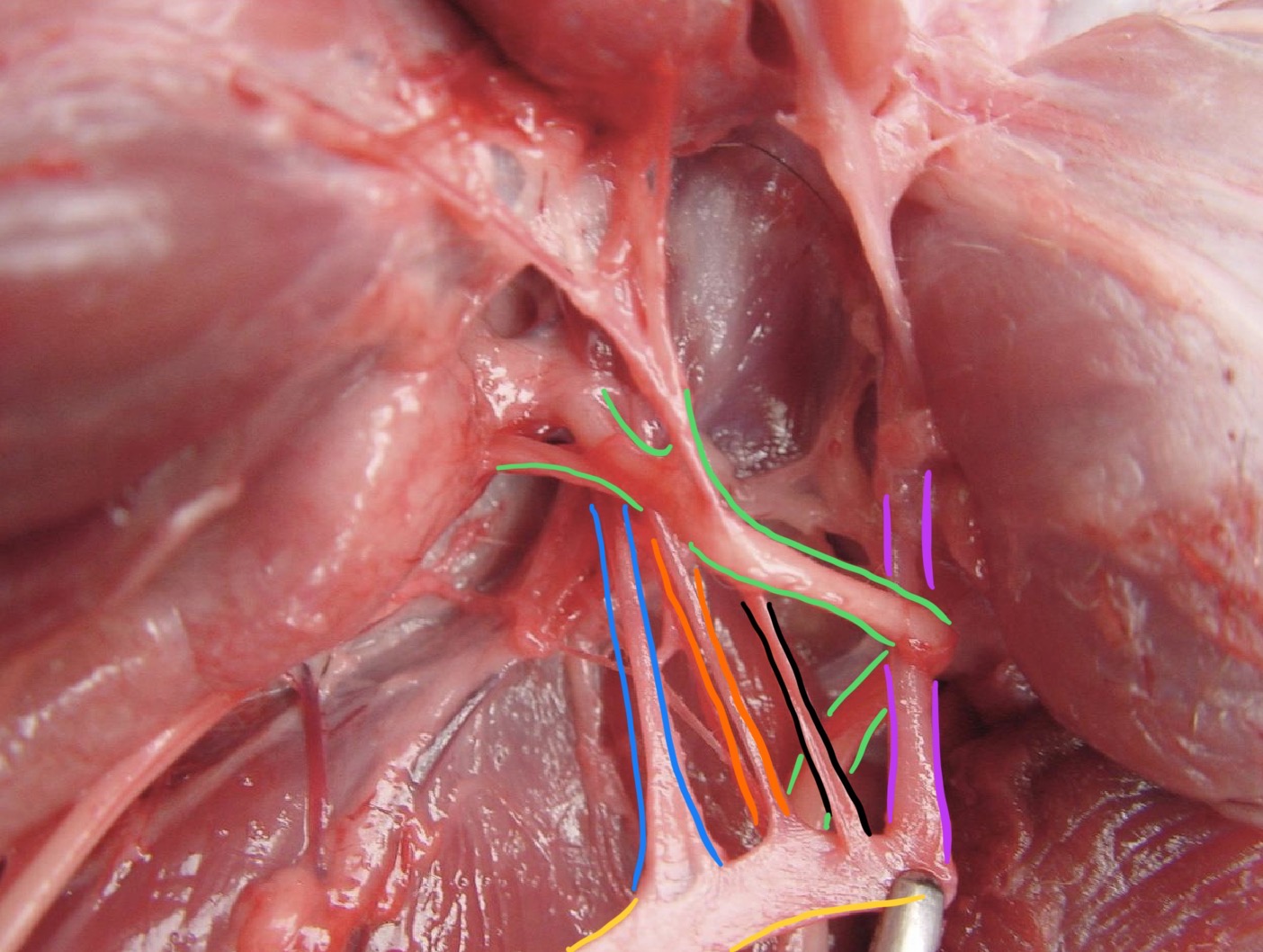 <p>Identify the structures that branch off from the common carotid artery. </p>