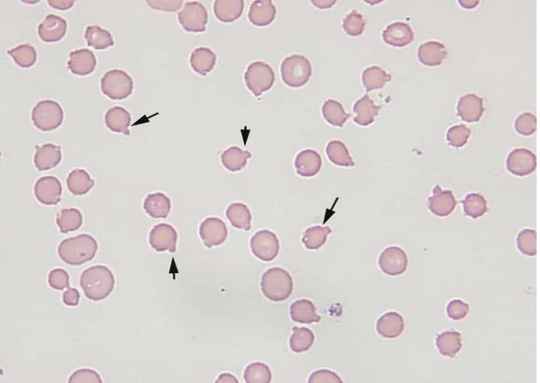 <p>What type of red blood cell is this?</p>