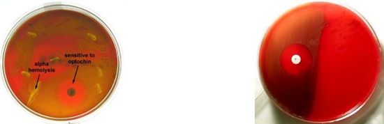 <p>Which microorganism causes <strong>partial alpha hemolysis</strong> on <strong>blood agar plates</strong> <strong>with a greenish color</strong> and is <strong>sensitive to Optichin (P disc)</strong>?</p>