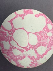 <p>Edge view, alveoli</p>