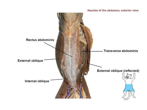<p>Rectus abdominis</p>