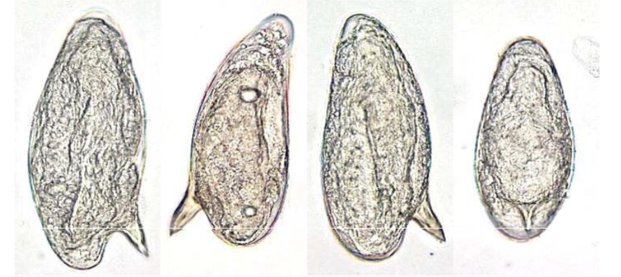 <p>Keywords for Schistosoma mansoni</p>