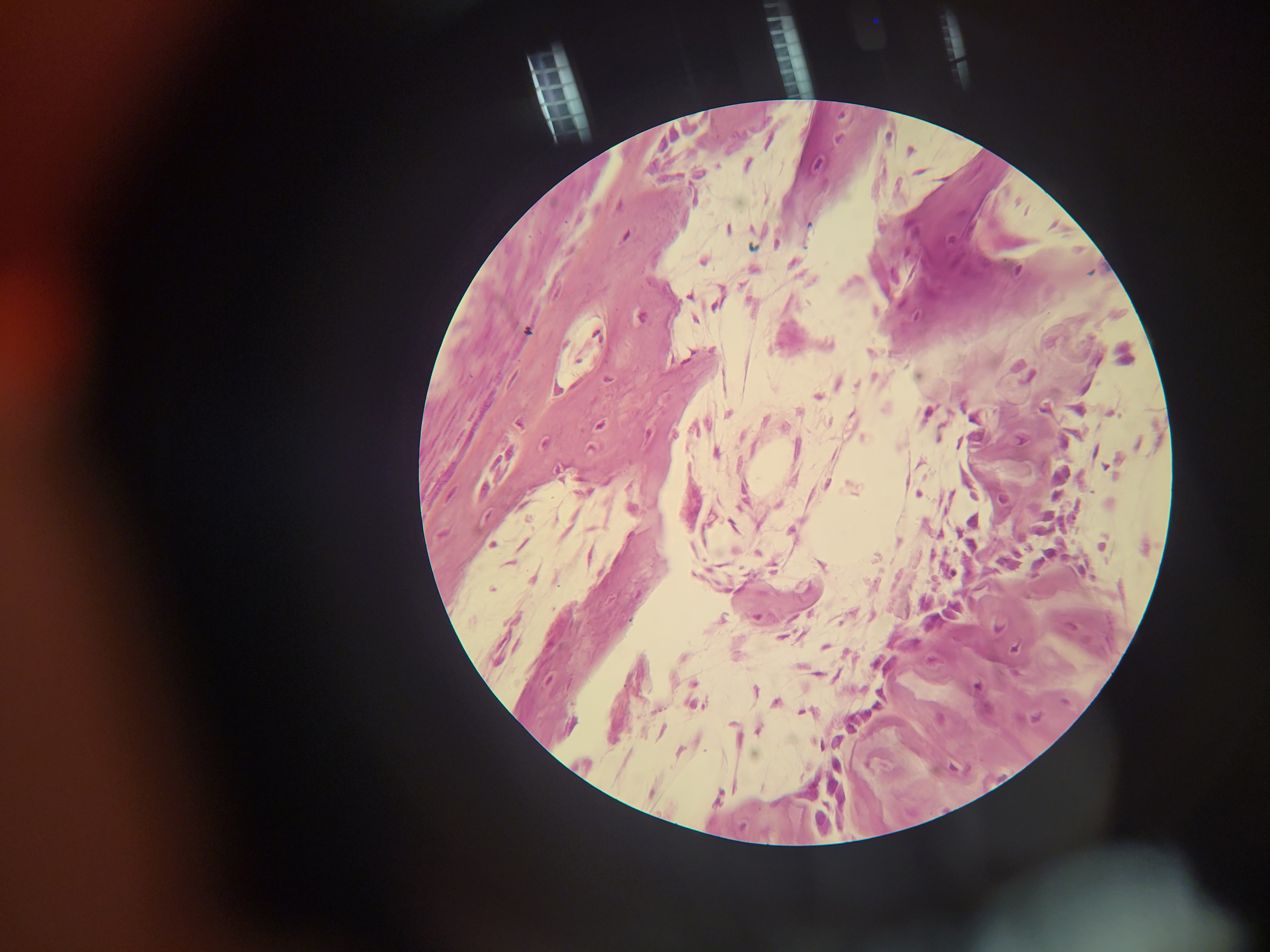 <p>What image is shown? What are the features?</p>