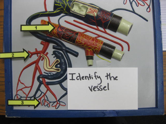 <p>Identify The Vessel 1, 2 and 3?</p><p>Lab Image 3-2</p>