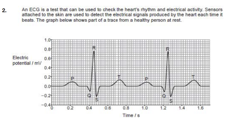 <p>(ii) Calculate the heart rate of the person in beats per minute = (bpm)</p>