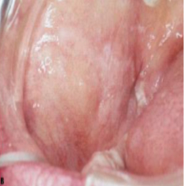 <p>what is this condition</p>