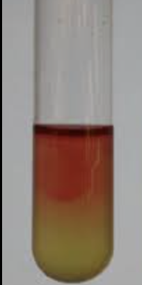 <p>This Vogues-Proskauer Test is ________ (positive or negative) and means that _______ was fermented via a butanediol pathway.</p>
