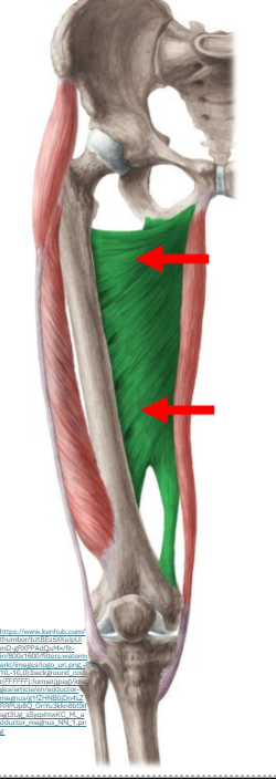 <p><span><strong>Origo pars superior en pars media</strong>:</span><span style="line-height: 31px;"><br></span><span style="line-height: 0px;">ramus inferior ossis pubis en ramus ossis ischii </span><span style="line-height: 31px;"><br><br></span><span><strong>Insertie: </strong></span><span style="line-height: 31px;"><br></span><span style="line-height: 0px;">linea aspera femoris </span></p><p class="Paragraph WhiteSpaceCollapse SCXP95723606 BCX8" style="text-align: left;"><span style="line-height: 0px;"></span></p><p class="Paragraph WhiteSpaceCollapse SCXP95723606 BCX8" style="text-align: left;"><span><strong>Functie</strong>: </span><span style="line-height: 31px;"><br></span><span>art. Coxae:</span><span style="line-height: 31px;"><br></span><span>* <em>adductie</em></span><span style="line-height: 31px;"><br></span><span>* geringe <em>anteflexie</em></span><span style="line-height: 31px;"><br></span><span>* <em>exorotatie</em></span><span style="line-height: 31px;"><br></span><span style="line-height: 0px;"></span></p>