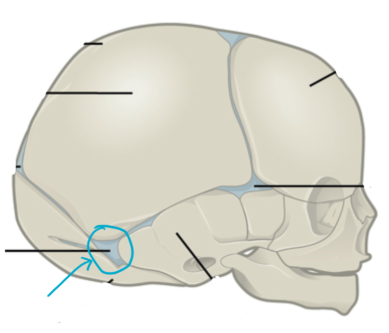 <p>ID skull region</p>